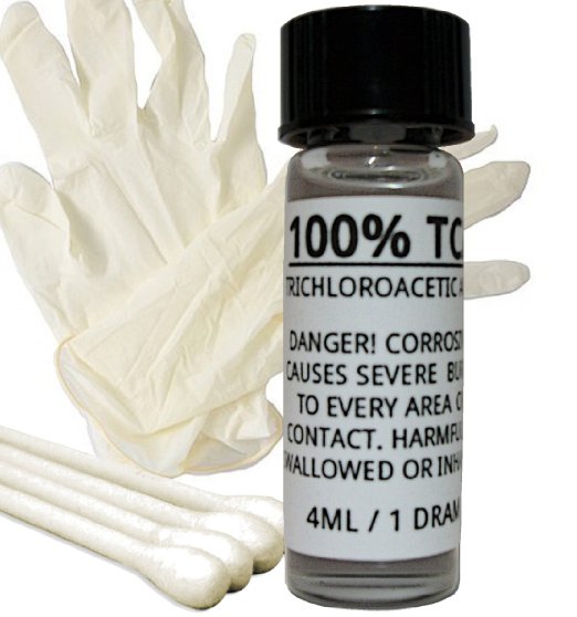 tattoo removal tca cream remove creams peel skin kit tattoos counter removing permanent try bought using tattoo removal tca cream remove creams peel skin kit tattoos counter removing permanent try bought using